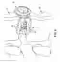 Fig. 07 - FUSION CAGE WITH REVERSE THREAD PROFILE (RTP)