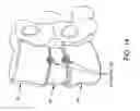 Fig. 15 - FUSION CAGE WITH REVERSE THREAD PROFILE (RTP)