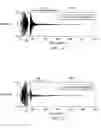 Fig. 06 - Reducing the ringing of actuator elements in ultrasound based health monitoring systems