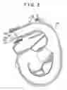 Fig. 03 - INTAKE SYSTEM FOR AN INTERNAL COMBUSTION ENGINE