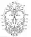 Fig. 04 - Manifold for use in medicament dispenser