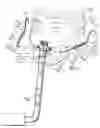Fig. 02 - Nasal CPAP securement system