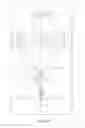 Fig. 02 - Compensation of dose inhomogeneity and image distortion