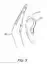 Fig. 04 - Switch for a hearing aid