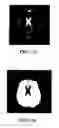 Fig. 06 - Registering brain images by aligning reference ellipses