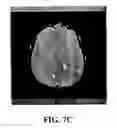 Fig. 07 - Registering brain images by aligning reference ellipses