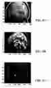 Fig. 08 - Registering brain images by aligning reference ellipses