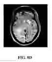 Fig. 09 - Registering brain images by aligning reference ellipses