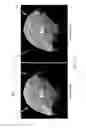 Fig. 02 - Enhanced ghost compensation for stereoscopic imagery