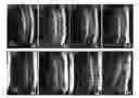Fig. 01 - Treatment of Injuries to the Central Nervous System