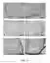 Fig. 11 - CELLS FOR THERAPY OF THE HEART, METHOD OF OBTAINING A CELL PREPARATION, AND CELL PREPARATION