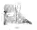 Fig. 02 - Fixation devices for tissue repair