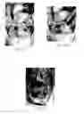 Fig. 06 - Fixation devices for tissue repair