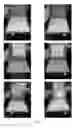 Fig. 06 - Negative electrode for hybrid energy storage device