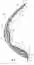 Fig. 06 - Bra cup for augmenting breasts and brassiere having the same