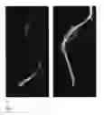 Fig. 08 - Bone morphogenetic protein 3 and osteogenic devices and pharmaceutical products containing thereof