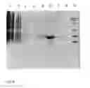 Fig. 09 - Bone morphogenetic protein 3 and osteogenic devices and pharmaceutical products containing thereof