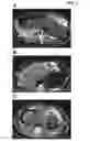 Fig. 02 - OILY PACLITAXEL COMPOSITION AND FORMULATION FOR CHEMOEMBOLIZATION AND PREPARATION METHOD THEREOF
