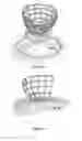 Fig. 11 - INTERVENTIONAL IMMOBILIZATION DEVICE