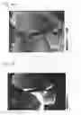 Fig. 04 - Process for quantitative display of blood flow