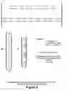 Fig. 03 - Three-dimensional localization, display, recording, and analysis of electrical activity in the cerebral cortex
