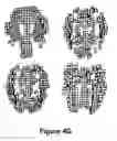 Fig. 06 - Three-dimensional localization, display, recording, and analysis of electrical activity in the cerebral cortex