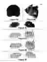 Fig. 07 - Three-dimensional localization, display, recording, and analysis of electrical activity in the cerebral cortex