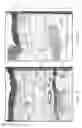 Fig. 12 - Apparatus and methods for the destruction of adipose tissue