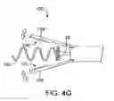 Fig. 07 - Needle assembly for tissue manipulation