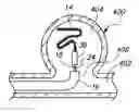 Fig. 01 - VASO-OCCLUSIVE DEVICE HAVING PIVOTABLE COUPLING