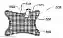 Fig. 01 - SURGICAL SPACER
