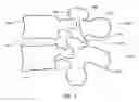 Fig. 02 - SURGICAL SPACER