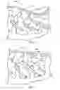 Fig. 03 - SURGICAL SPACER