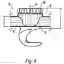 Fig. 05 - Spinal fixation system