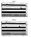 Fig. 07 - Electrical stimulation treatment of bronchial constriction