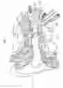Fig. 02 - Implantable middle ear transducer having improved frequency response