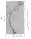 Fig. 09 - Implantable middle ear transducer having improved frequency response