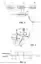 Fig. 02 - SYSTEM AND METHOD FOR TRANSVASCULAR ACTIVATION OF CARDIAC NERVES TO IMPROVE HEART FUNCTION