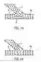 Fig. 02 - Method and apparatus for stenting