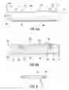 Fig. 07 - Method and apparatus for stenting