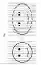 Fig. 07 - Laser-marked multi-component assemblies, kits, and related methods