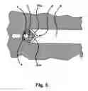Fig. 06 - Method and system for laser processing
