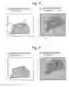 Fig. 06 - Mass spectrometer