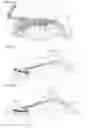Fig. 07 - APPARATUS FOR CORRECTING POSITION OF TEETH