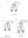 Fig. 07 - Device, system and method for procedures associated with the intra-oral cavity