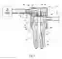 Fig. 06 - Apparatus and methods for treating tooth root canals