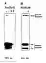 Fig. 05 - Target and method for inhibition of bacterial RNA polymerase