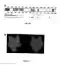Fig. 07 - Target and method for inhibition of bacterial RNA polymerase
