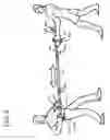 Fig. 04 - Resistance exercise device