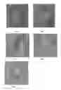 Fig. 02 - GLYCOPROTEIN FOR TREATING CHRONIC OBSTRUCTIVE PULMONARY DISEASES